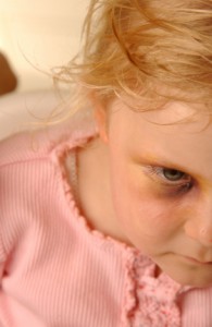 Texas Daycare Abuse and Child Abuse